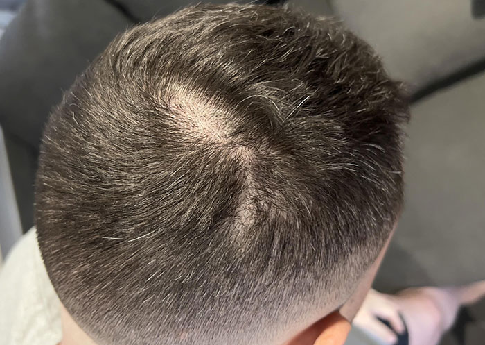 Fui a un barbero nuevo y me ha dejado una calva