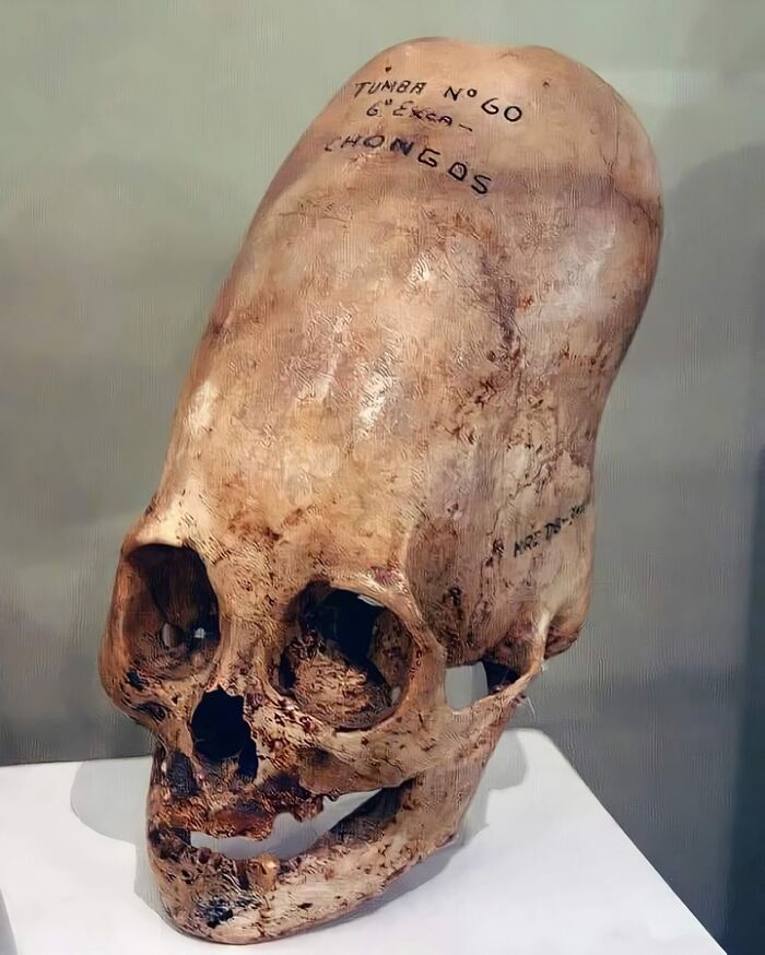 Un arqueólogo peruano descubrió más de 300 cráneos misteriosos que se cree que tienen al menos 3.000 años de antigüedad. El volumen de estos cráneos es un 25% mayor que el de un cráneo humano medio y pueden pesar hasta un 60% más.