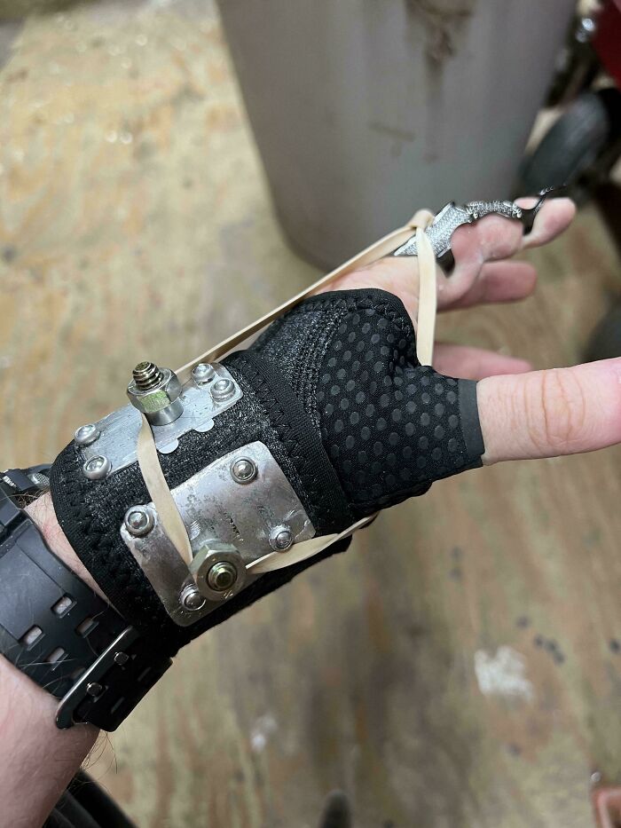 Me corté un nervio y perdí un tercio de la movilidad del dedo. Esta prótesis del estilo Frankenstein que hicimos con mi padre me ayuda con la recuperación