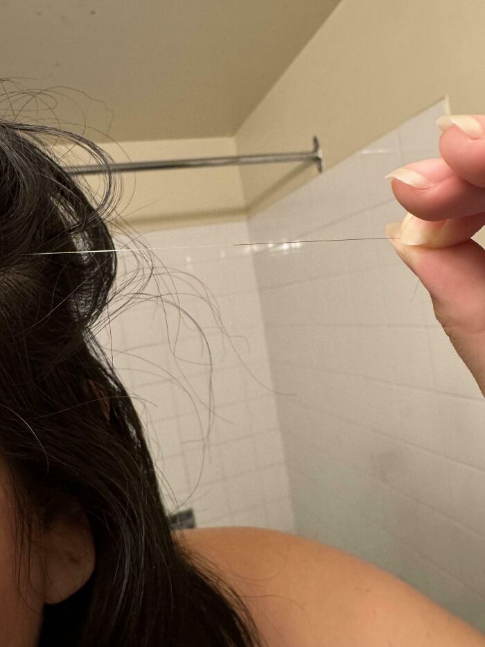 Puedes ver dónde empezó a crecerme el pelo blanco en lugar de mi color natural