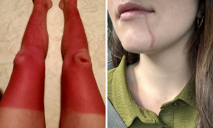 37 Personas que llevan un día peor que el tuyo (nuevas fotos)
