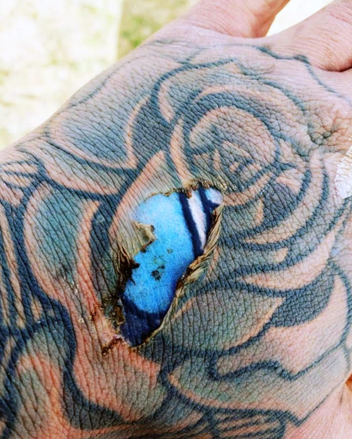 Una quemadura en la mano revela un tatuaje como si fuera reciente
