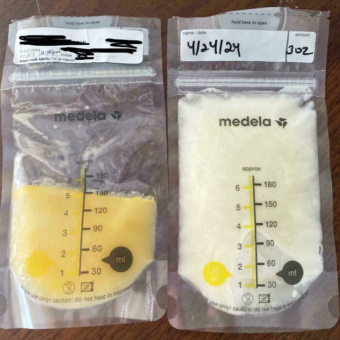 Diferencia de color de la leche materna 3 días después del parto frente a 8 semanas después del parto