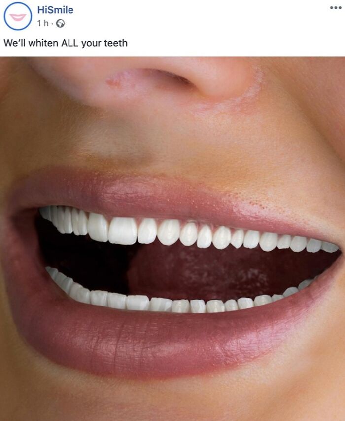 Este anuncio de blanqueamiento dental no pasará inadvertido