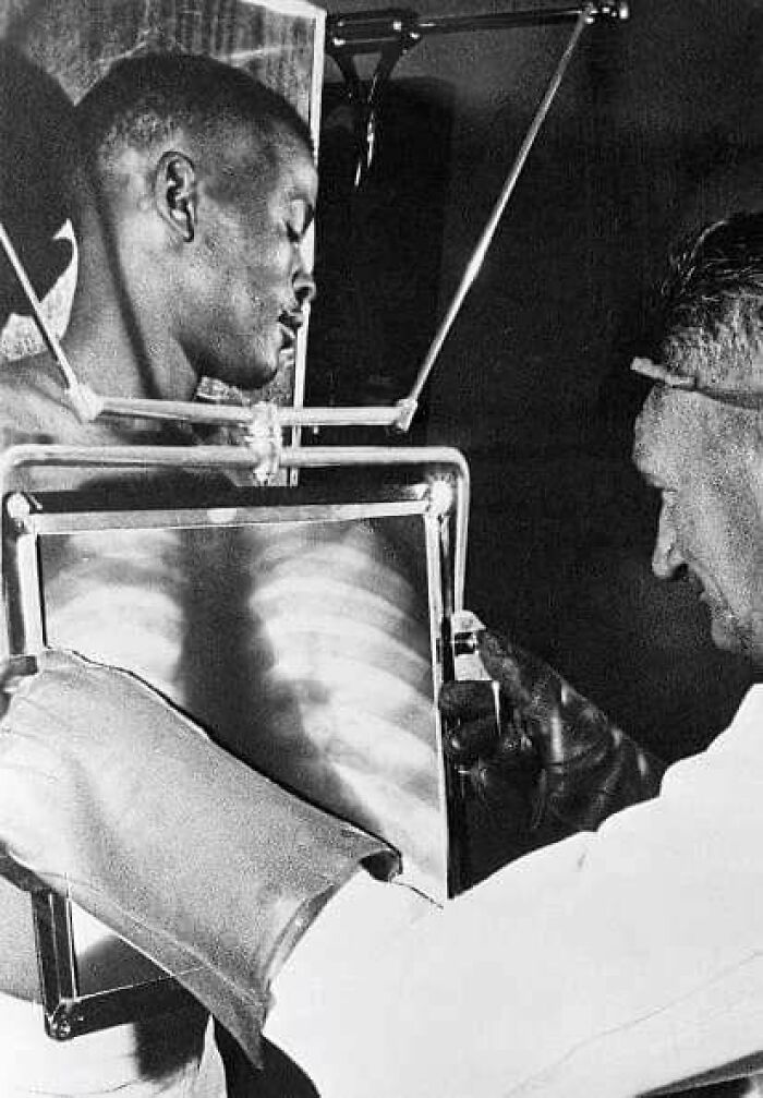 Un trabajador de una mina de diamantes es sometido a una radiografía al final de cada turno antes de abandonar las minas. Sudáfrica, 1954