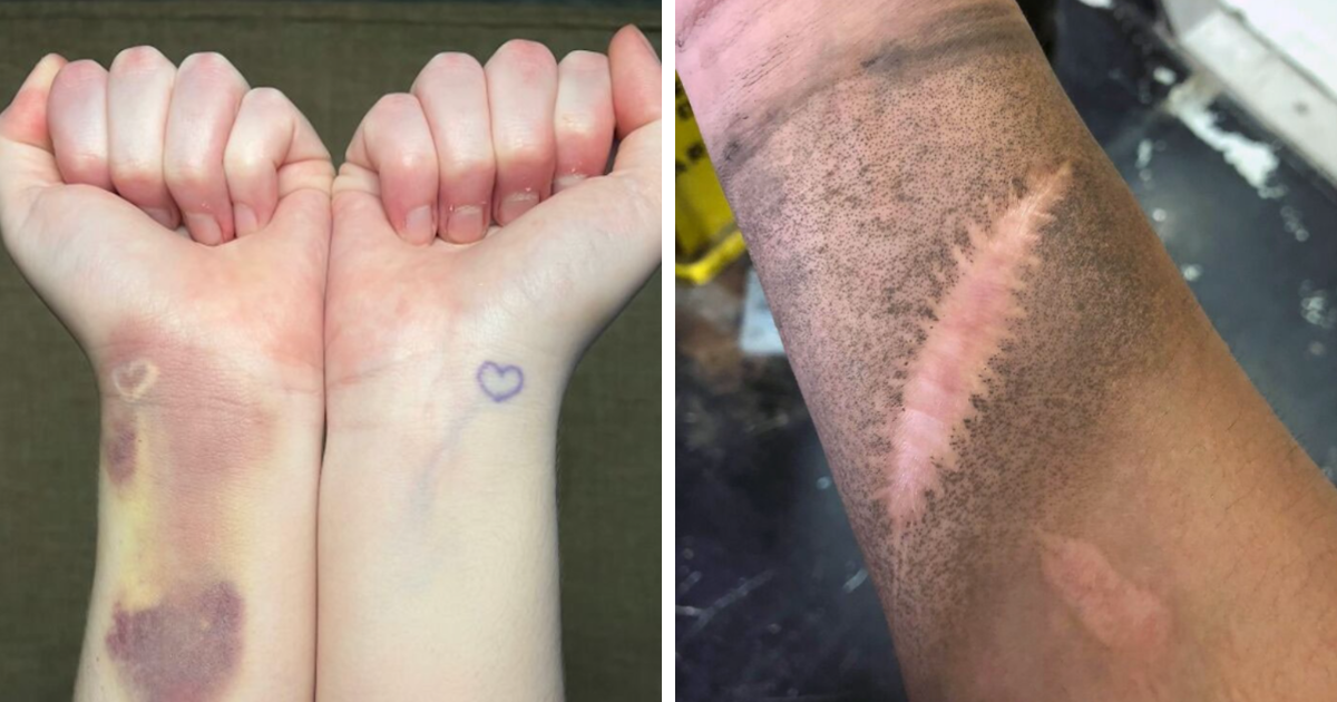 35 Imágenes interesantes y únicas del cuerpo humano