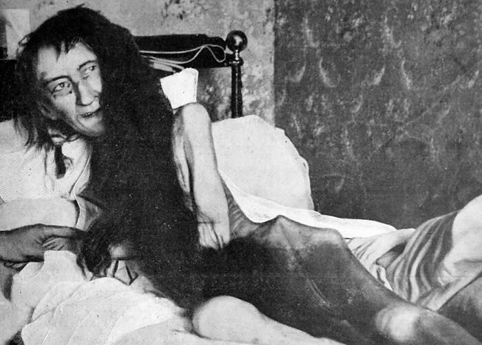 Blanche Monnier era una dama de la alta sociedad francesa a la que su madre encerró en un desván durante 25 años sin darle la luz del sol. Cuando la descubrieron estaba cubierta de comida vieja y heces, con bichos por toda la cama y el suelo, pesaba apenas 25 kilos
