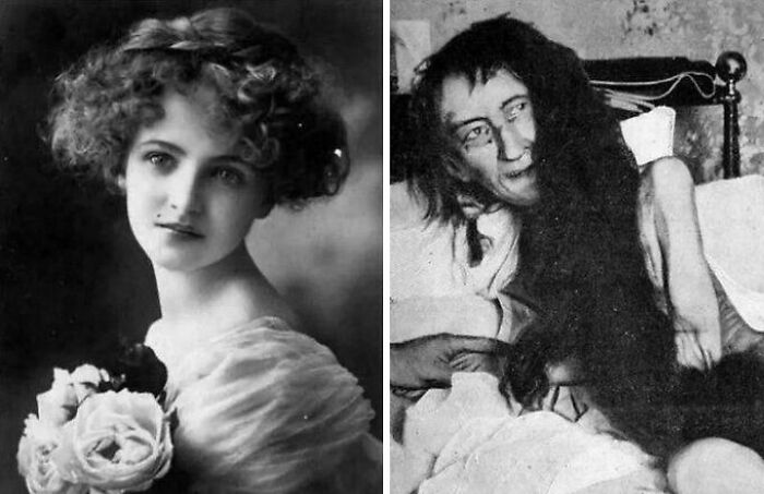 Dos mujeres en imágenes antiguas, una con flores y otra con cabello largo, representan sucesos casi increíbles.