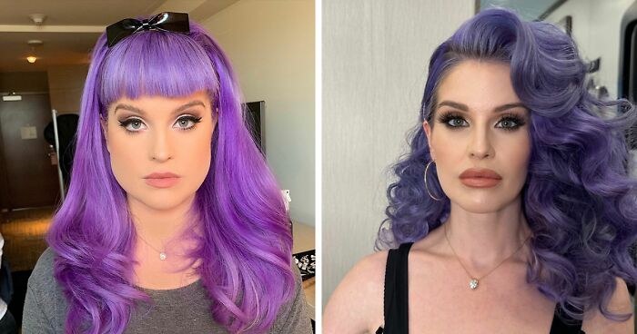 22 Fotos comparativas de celebridades que se cree que usan el medicamento Ozempic
