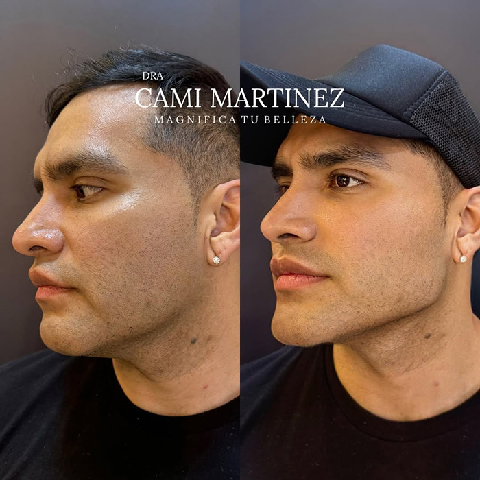 Before and after plastic surgery transformation.