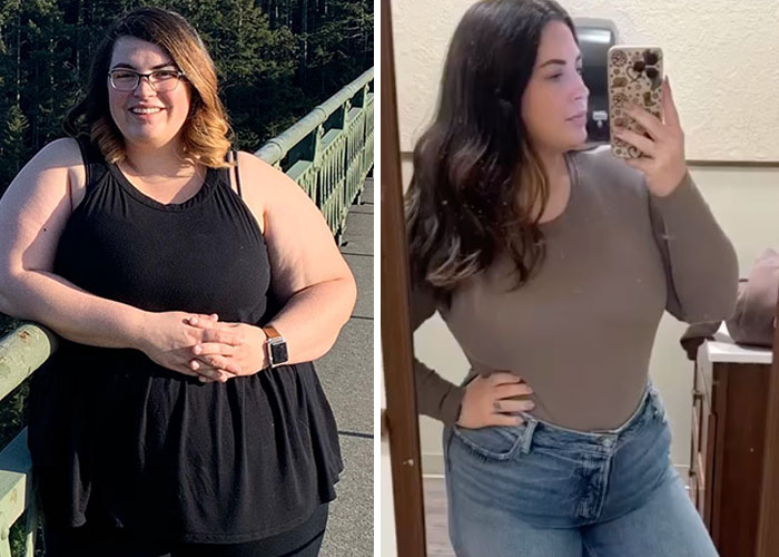 Two friends show different results after starting Ozempic, highlighting varied experiences with the medication.
