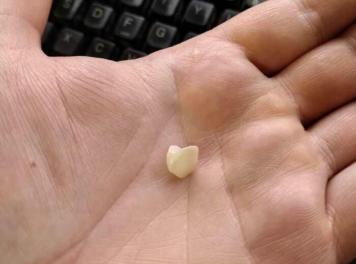 Persona sosteniendo un pequeño diente en la palma de la mano sobre un teclado. Peor día en el trabajo.
