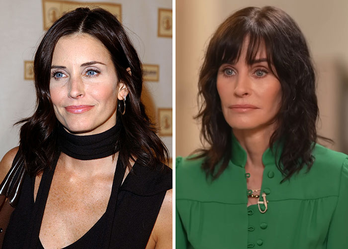 Mujer con cabello oscuro antes y después de cirugía plástica, mostrando efectos notorios.
