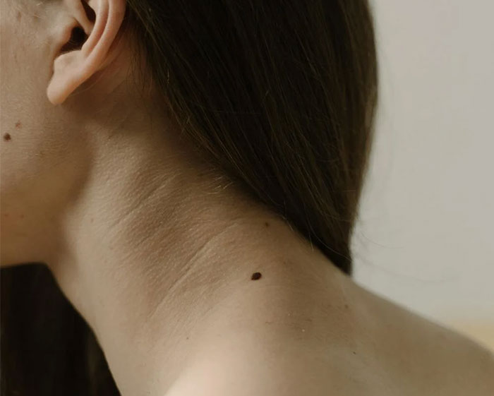 Mujer con un lunar visible en el cuello, iluminada sutilmente.