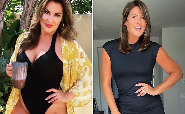 Mujer mostrando cambio físico pronunciado antes y después de quitarse implantes de pecho en dos fotos comparativas.