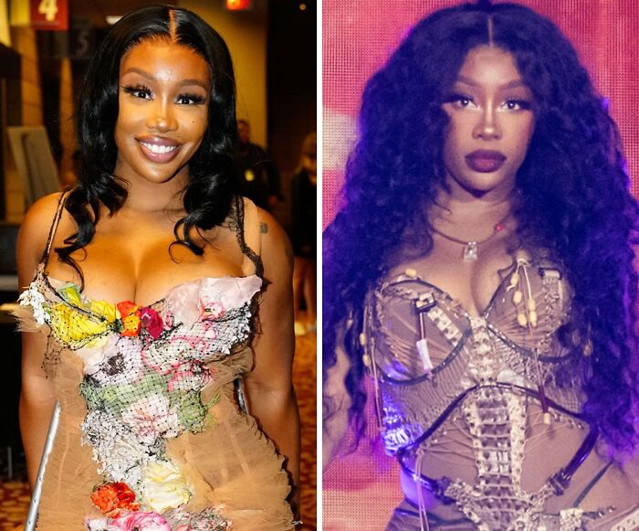 Mujer con vestido ajustado mostrando cambio tras quitarse implantes de pecho en fotos de antes y después