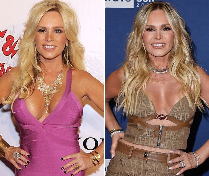 Mujer rubia en fotos de antes y después mostrando resultados tras quitarse implantes de pecho, en eventos públicos.