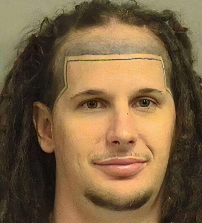 Hombre con tatuaje en rostro que simula contorno de cabello irregular, ejemplo de tatuajes horribles.