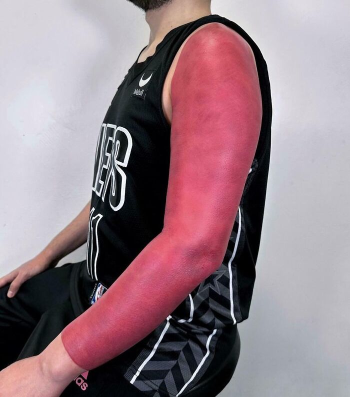 Brazo tatuado completamente en rojo, mostrando un ejemplo de tatuajes que fueron una mala elección.