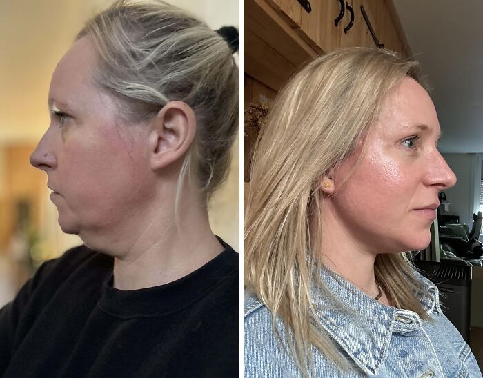 Mujer mostrando pequeños cambios de apariencia que marcaron la diferencia en su rostro en fotos de antes y después.