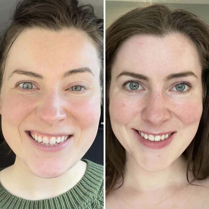 Mujer mostrando pequeños cambios de apariencia que marcaron la diferencia en su rostro y expresión facial.