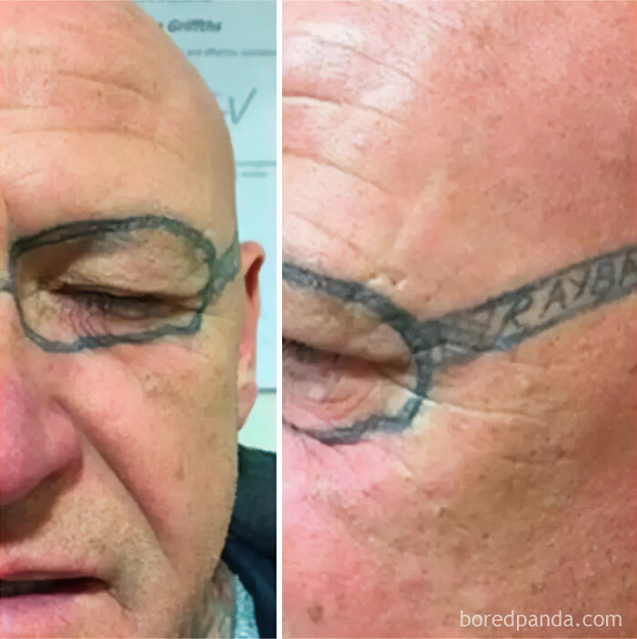 Hombre con un tatuaje inusual de gafas azules pintadas en la cara, mostrando una creatividad peculiar en sus tatuajes.