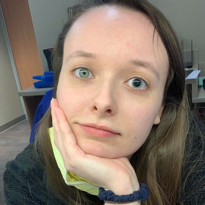 Joven con ojos de diferente color, ejemplo de personas que recibieron genes muy buenos o muy malos en su apariencia.