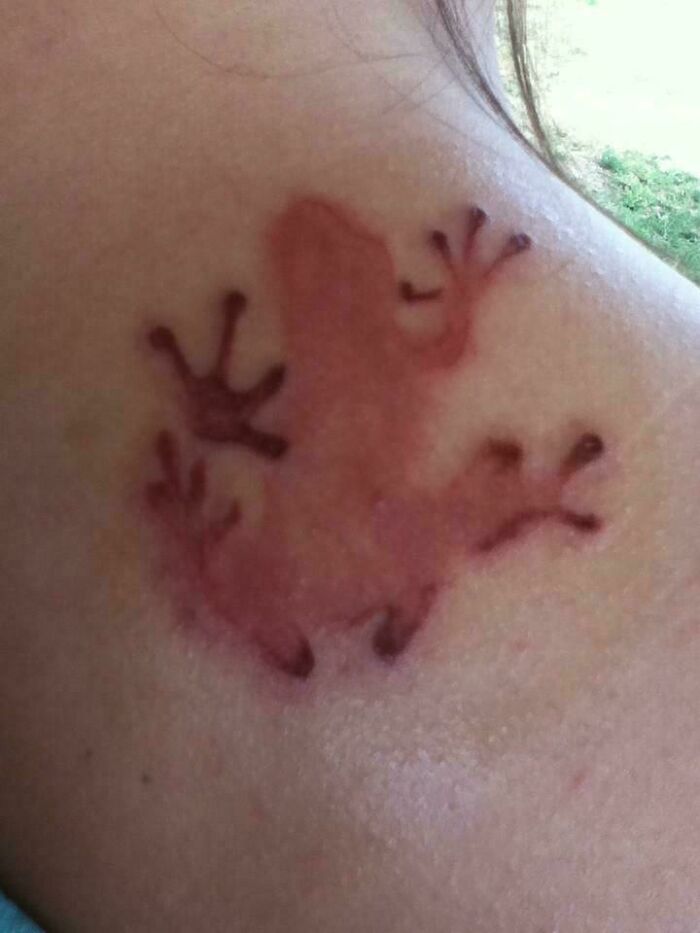 Tatuaje de rana quemada que parece bendecida y maldita al mismo tiempo en el hombro de una persona.