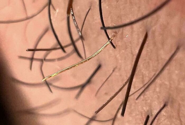 Primer plano de folículo piloso con pelo dorado entre otros oscuros en una imagen curiosa del cuerpo humano.