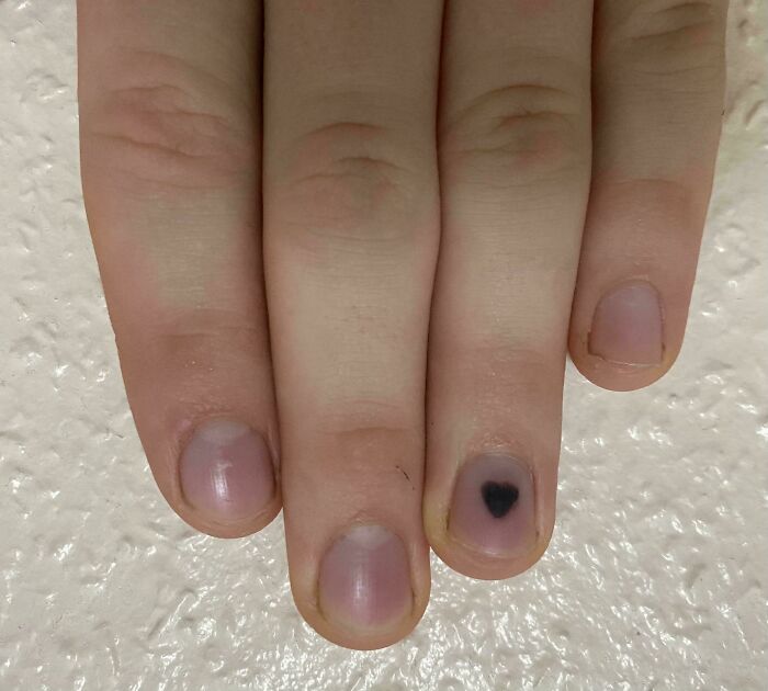 Uña con mancha en forma de corazón en dedo de mano, detalle curioso del cuerpo humano y sus peculiaridades.