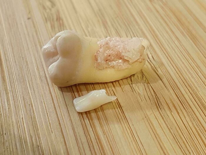 Diente humano extraído con caries y fragmento pequeño sobre superficie de madera, imagen interesante del cuerpo humano.