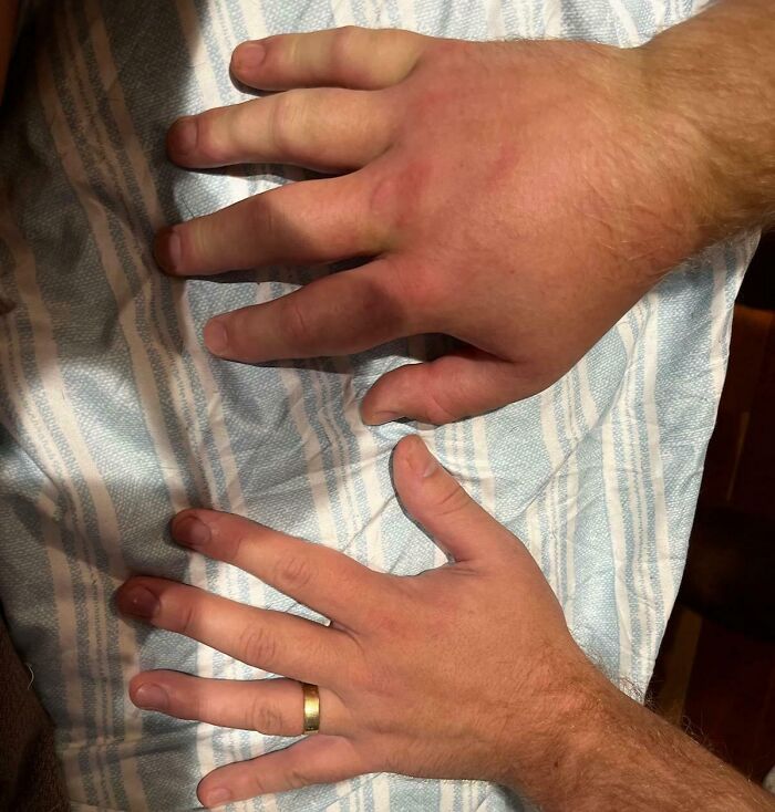 Manos con diferencia notable en tamaño y color, imagen impactante para fotos tan interesantes que parece ilegal mirarlas sin protección.
