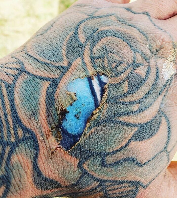 Herida en mano tatuada con piel rasgada mostrando capa interna en fotos médicas fascinantes e inquietantes de diagnóstico visual.