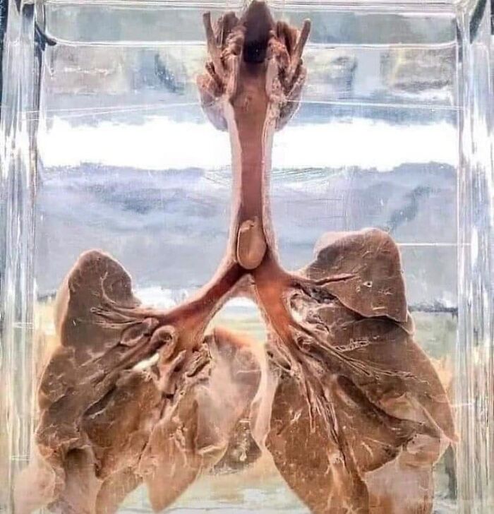 Pulmones humanos conservados en un líquido transparente, mostrando detalles anatómicos para fotos médicas fascinantes.