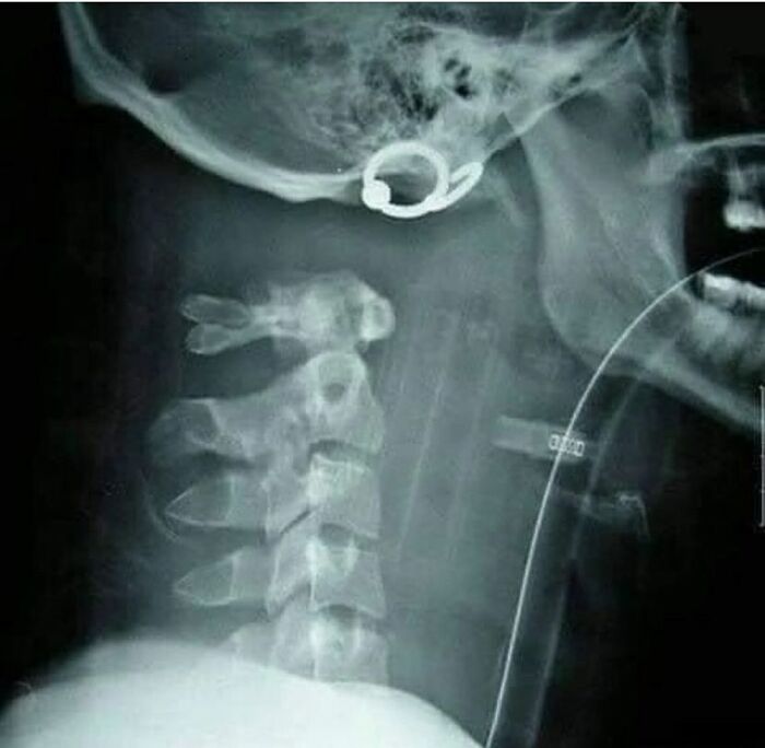 Radiografía médica que muestra rarezas y detalles del cuerpo humano sorprendentes y a veces aterradores.