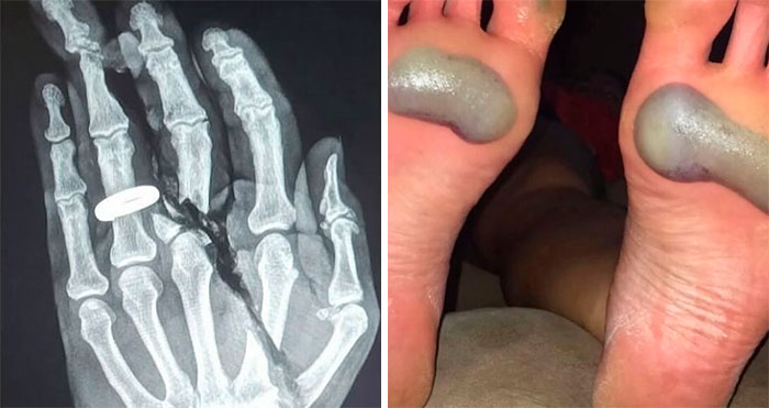 38 Fotos médicas que demuestran que el cuerpo es a veces aterrador