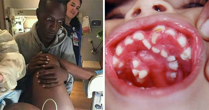 31 Fotos médicas tan fascinantes como inquietantes
