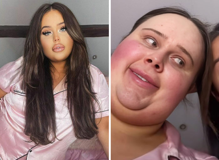 Comparación de Instagram VS realidad mostrando la diferencia entre una foto editada y la verdadera apariencia natural.