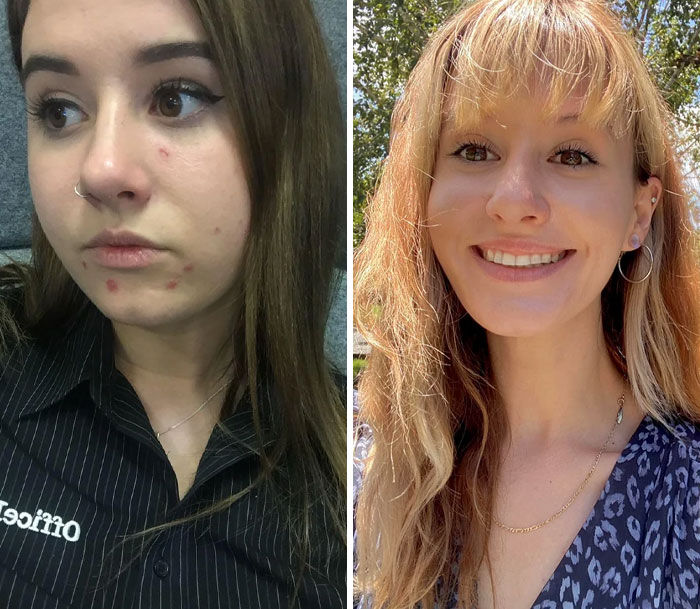 Comparación del cambio de apariencia en mujeres, mostrando transformación en el rostro y mejora de la piel con pequeños ajustes.
