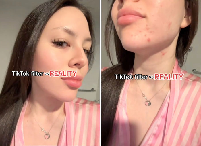 Comparación de filtro TikTok con realidad mostrando edición excesiva y piel con imperfecciones visibles en internet.