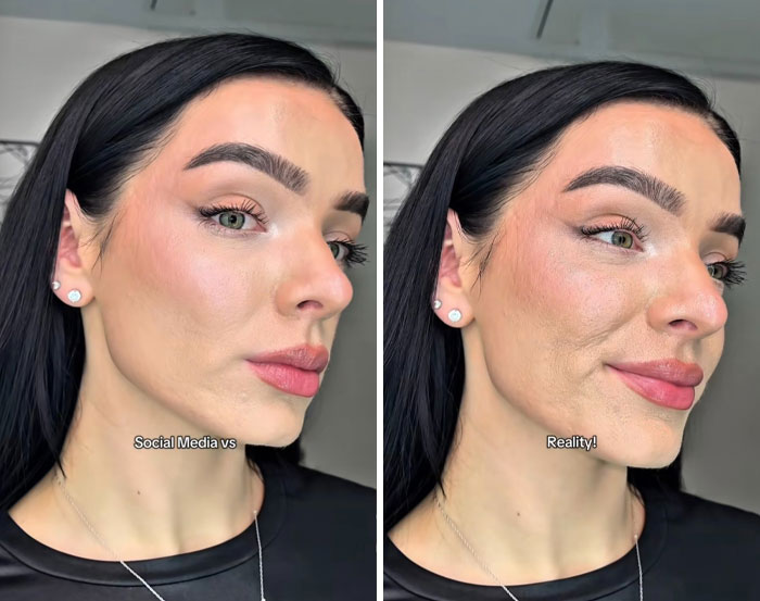 Comparación de fotos editadas en redes sociales y la realidad mostrando exceso de edición en la piel y rasgos faciales.