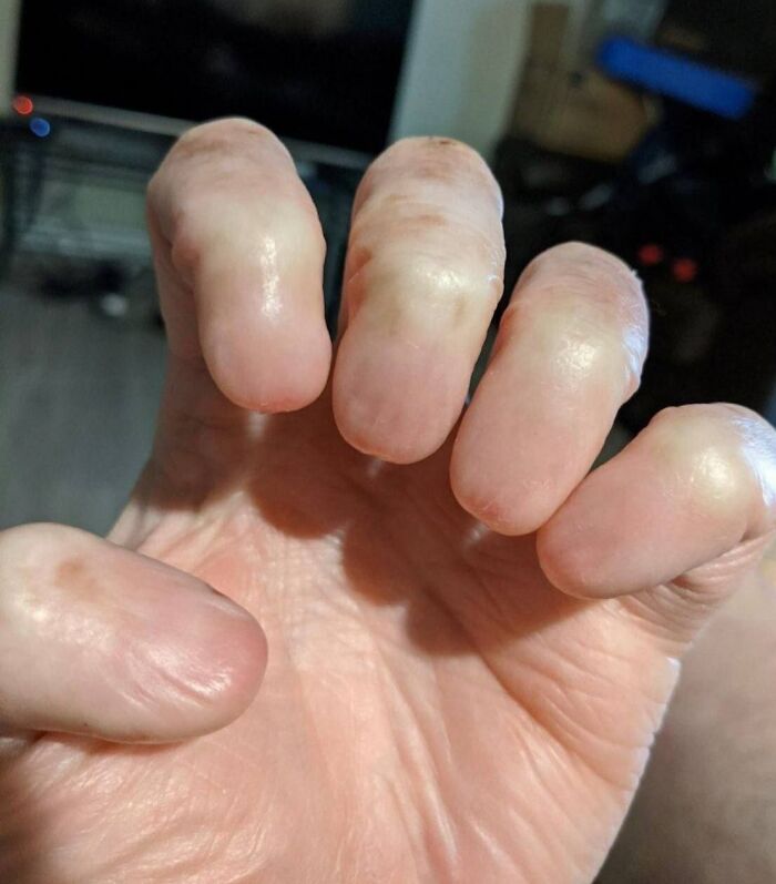 Dedos de mano humana con piel arrugada y curvada, detalle cercano mostrando curiosidades del cuerpo humano.