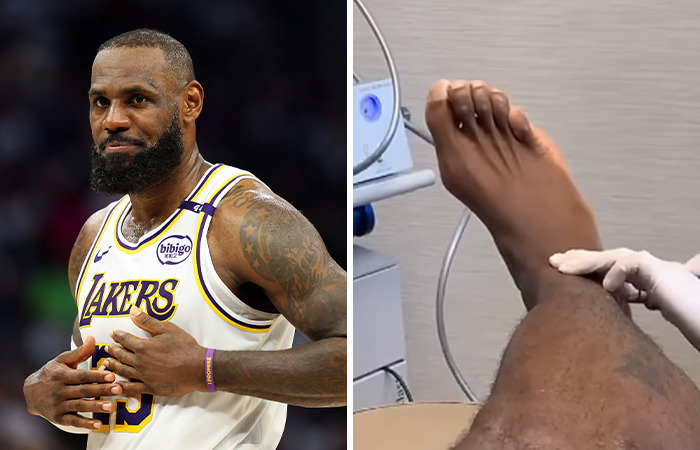 LeBron James, estrella de los Lakers, mostrando peculiaridades corporales en brazo y pie durante revisión médica.
