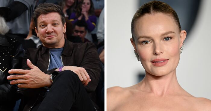 20 Celebridades con peculiaridades corporales que quizá no habías notado