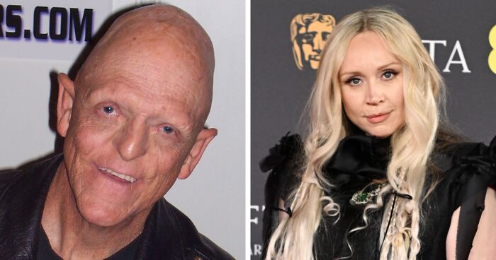 25 Celebridades que aceptan sus peculiaridades únicas