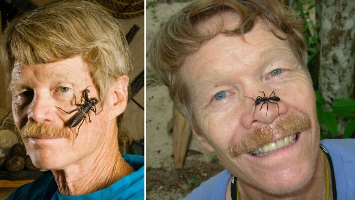 Hombre mayor con insectos grandes en la cara, ilustrando diferencias en la longevidad entre mujeres y hombres.