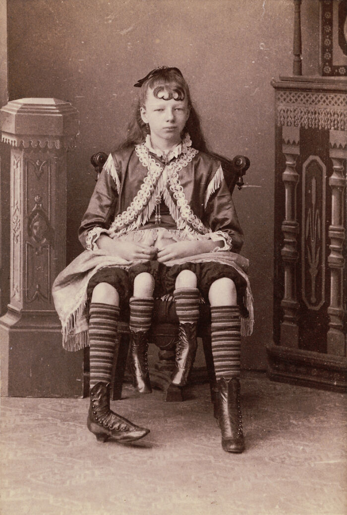 Niña con pierna doble sentada en una silla antigua, imagen inquietante de fotos del pasado raras y sorprendentes.