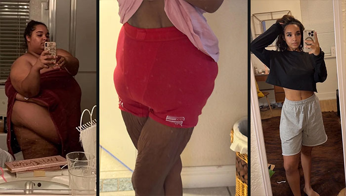 Antes y después de cirugía plástica, transformación sorprendente de personas que se ven irreconocibles post operación.