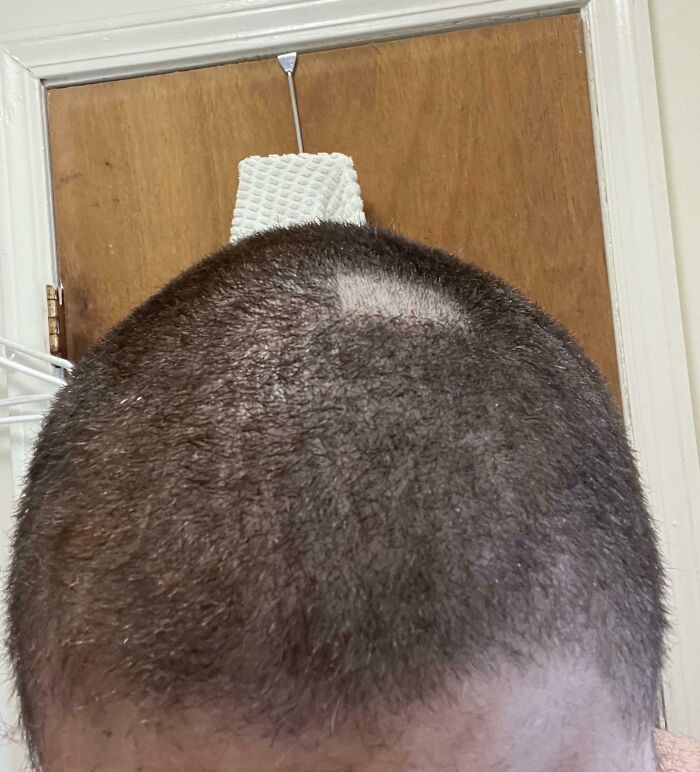 Primer plano de una cabeza con corte de cabello mal hecho, mostrando consecuencias de olvidar algo importante.