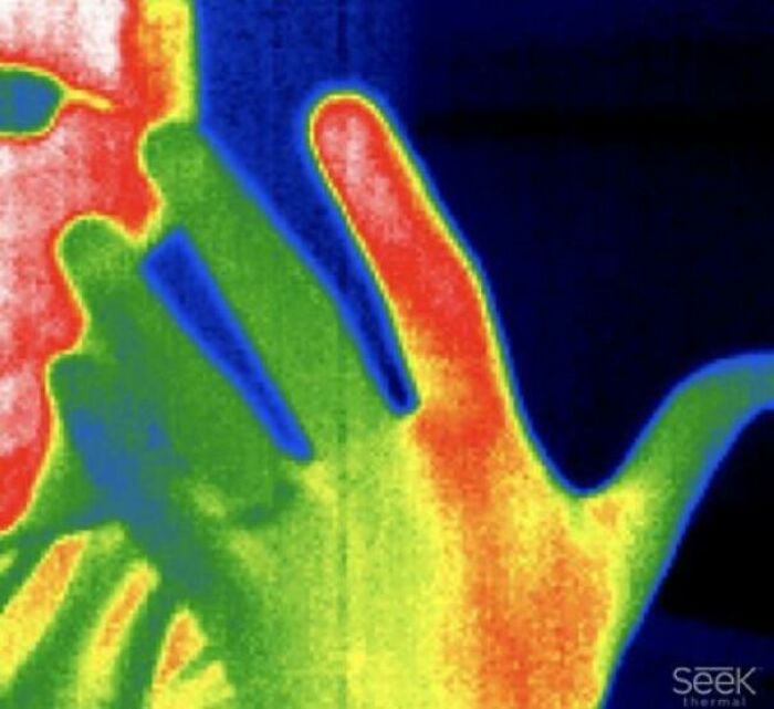 Imagen térmica médica que muestra temperaturas variables en la mano y rostro, destacando detalles del cuerpo humano aterrador.